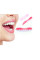 Знімні вініри для зубів верхньої щелепи з кейсом Veneers Smile