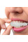 Знімні вініри для зубів верхньої щелепи з кейсом Veneers Smile