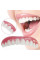 Знімні вініри для зубів верхньої щелепи з кейсом Veneers Smile